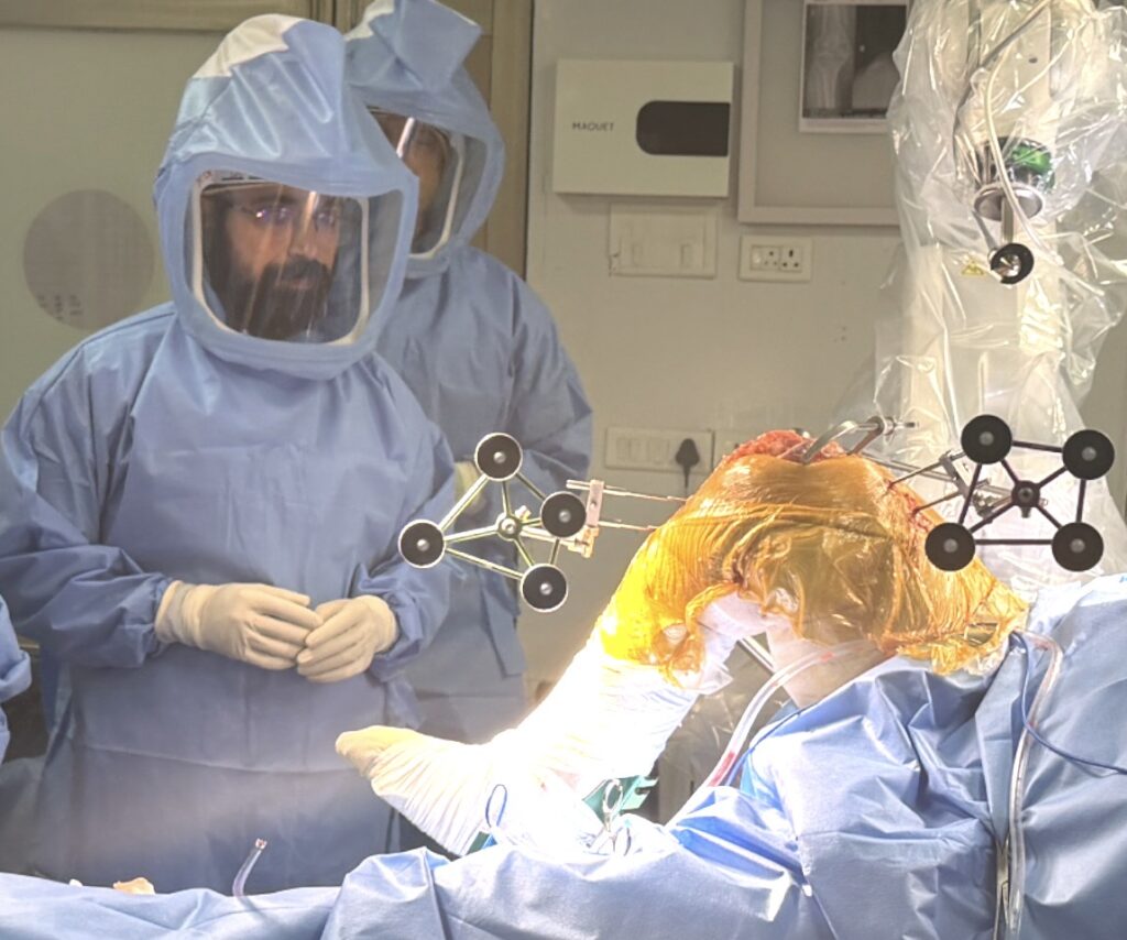 Robotic Knee Surgery Procedure Mohali